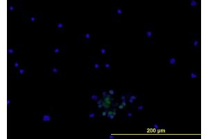 Immunofluorescence of monoclonal antibody to ENG on PBMCs cell .