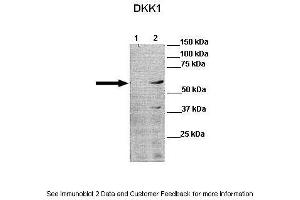 Lanes:   Lane 1: 30ug human PLC/PRF5 cell lysate Lane 2: 30ug DKK1 PLC/PRF5 cell lysate   Primary Antibody Dilution:   1:1000  Secondary Antibody:   Anti-rabbit-HRP Anti-rabbit-HRP  Secondary Antibody Dilution:   1:10,000  Gene Name:   DKK1 a  Submitted by:   Dr Frankie Ko Chi Fat, Lo-Kong Chan, Irene O.