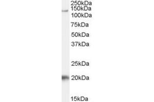 ABIN334420 (1µg/ml) staining of Daudi cell lysate (35µg protein in RIPA buffer).