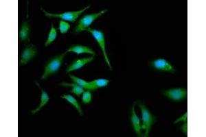Immunofluorescence staining of Hela cells with ABIN7146380 at 1:133, counter-stained with DAPI. (CABP4 antibody  (AA 1-107))