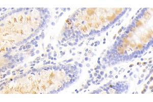 Detection of SCG3 in Human Colon Tissue using Polyclonal Antibody to Secretogranin III (SCG3) (SCG3 antibody  (AA 20-468))