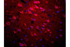 Formalin-fixed and paraffin embedded rat brain labeled with Rabbit Anti-APOE3 Polyclonal Antibody, Unconjugated used at 1:200 dilution for 40 minutes at 37°C. (APOE antibody  (AA 101-180))