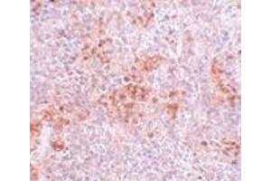 Immunohistochemistry of BFAR in mouse kidney tissue with BFAR antibody at 5 μg/ml. (BFAR antibody  (C-Term))