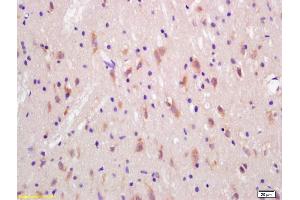 Formalin-fixed and paraffin embedded rat brain labeled with Rabbit Anti Huntingtin Polyclonal Antibody, Unconjugated (ABIN1387692) at 1:200 followed by conjugation to the secondary antibody and DAB staining