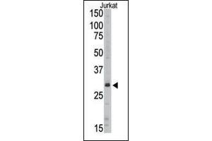 Western blot analysis of anti-SIRT5 Pab (ABIN390180 and ABIN2840671) in Jurkat cell line lysate (35 μg/lane). (SIRT5 antibody  (C-Term))