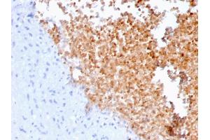 Formalin-fixed, paraffin-embedded human lung stained with Fodrin Mouse Monoclonal Antibody (SPTAN1/3352). (SPTAN1 antibody  (AA 2351-2475))