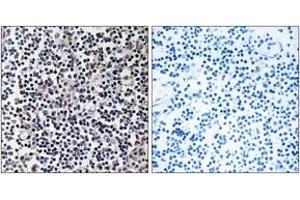 Immunohistochemistry analysis of paraffin-embedded human tonsil tissue, using TACC3 Antibody. (TACC3 antibody  (AA 789-838))