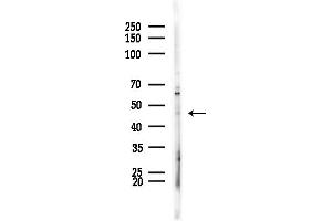 anti-Apolipoprotein L, 5 (APOL5) (C-Term) antibody