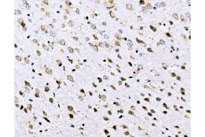 IHC analysis of VPRBP/DCAF1 using anti-VPRBP/DCAF1 antibody (ABIN7602005). (DDB1 and CUL4-Associated Factor 1 (DCAF1) (AA 540-861) antibody)