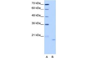 WB Suggested Anti-NOL6 Antibody Titration:  2. (Nucleolar Protein 6 antibody  (C-Term))