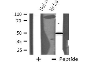 Western blot analysis of extracts from HeLa cells using MAPK10 antibody.