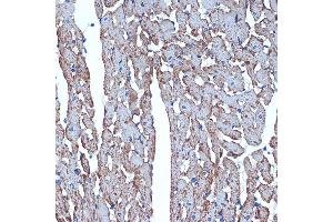 Immunohistochemistry of paraffin-embedded rat heart using CDC42EP1 Rabbit mAb (ABIN7266231) at dilution of 1:100 (40x lens). (CDC42EP1 antibody)