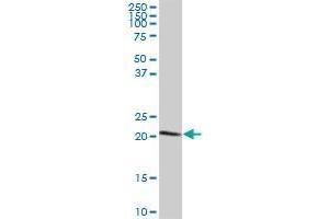 C7orf44 MaxPab polyclonal antibody. (C7orf44 antibody  (AA 1-146))