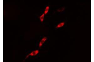 ABIN6276418 staining 293 cells by IF/ICC. (Caspase 1 antibody  (C-Term))