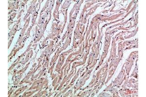 Immunohistochemical analysis of paraffin-embedded Human-heart, antibody was diluted at 1:100 (MIA antibody  (AA 90-131))