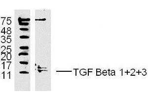 MDA-MB-231 lysates probed with TGF Beta 1+2+3 Polyclonal Antibody, unconjugated  at 1:300 overnight at 4°C followed by a conjugated secondary antibody at 1:10000 for 60 minutes at 37°C. (TGF-beta antibody  (AA 301-350))