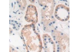 Figure. (PEPD antibody  (AA 2-493))