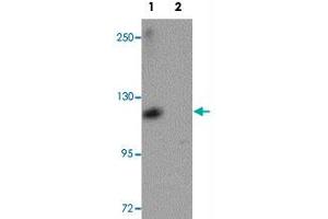 Western blot analysis of ATP11A in K-562 cell lysate with ATP11A polyclonal antibody  at 1 ug/mL in (1) the absence and (2) the presence of blocking peptide.