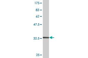 Western Blot detection against Immunogen (36. (S100A7 antibody  (AA 1-101))