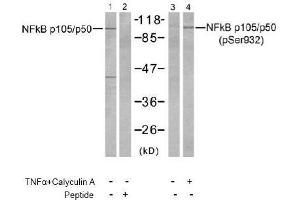 Image no. 2 for anti-Nuclear Factor of kappa Light Polypeptide Gene Enhancer in B-Cells 1 (NFKB1) (Ser932) antibody (ABIN197494) (NFKB1 antibody  (Ser932))