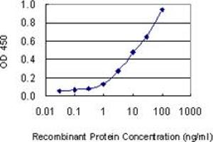 Detection limit for recombinant GST tagged KRT1 is 0. (Cytokeratin 1 antibody  (AA 387-496))