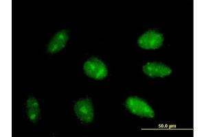 Immunofluorescence of purified MaxPab antibody to EXOSC3 on HepG2 cell. (EXOSC3 antibody  (AA 1-275))