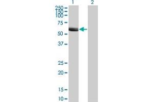 Western Blot analysis of LCK expression in transfected 293T cell line by LCK monoclonal antibody (M11), clone 3H5. (LCK antibody  (AA 1-100))