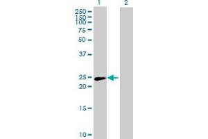 Western Blot analysis of PSMD10 expression in transfected 293T cell line by PSMD10 MaxPab polyclonal antibody. (PSMD10 antibody  (AA 1-226))
