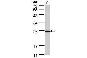 WB Image Sample (30 ug of whole cell lysate) A: HeLa 12% SDS PAGE antibody diluted at 1:1000 (KLRG1 antibody  (Center))