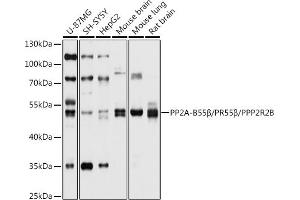 Western blot analysis of extracts of various cell lines, using PP2A-B55β/PR55β/PP2A-B55β/PR55β/PPP2R2B antibody (ABIN6132513, ABIN6146087, ABIN6146088 and ABIN6214771) at 1:1000 dilution.