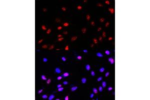 Immunofluorescence (IF) image for anti-Transcription Factor 4 (TCF4) (AA 400-500) antibody (ABIN3021530)