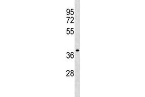 NDRG4 antibody western blot analysis in CEM lysate. (NDRG4 antibody  (AA 193-220))