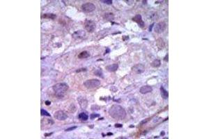 Image no. 2 for anti-Ret Proto-Oncogene (RET) (N-Term) antibody (ABIN359924) (Ret Proto-Oncogene antibody  (N-Term))