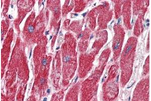 Anti-MMP14 antibody IHC of human heart. (MMP14 antibody  (AA 160-173))