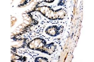 IHC-P: PLK2 antibody testing of rat intestine tissue (PLK2 antibody  (C-Term))