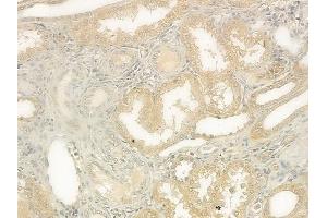 ABIN6263174 and ABIN6273136 at 1/100 staining human normal kidney tissue by IHC-P. (DIAPH1 antibody  (N-Term))