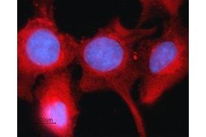 Expression of Connexin-43 in rat intestinal epithelial IEC-6 cells - Immunocytochemical staining of fixed and permeabilized rat intestinal epithelial IEC-6 cells. (Connexin 43/GJA1 antibody  (C-Term, Intracellular))