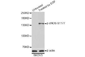 Western blot analysis of extracts of SKOV3 cells, using Phospho-eNOS-S1177 antibody (ABIN5995597). (ENOS antibody  (pSer1177))