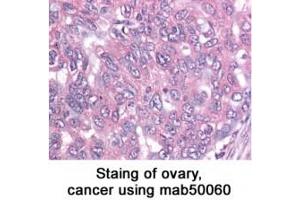 Image no. 2 for anti-Baculoviral IAP Repeat-Containing 5 (BIRC5) antibody (ABIN363214) (Survivin antibody)