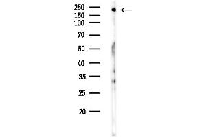 Western blot analysis of lysates from COLO205 cells(heat-shock,45 min treatment), using Phospho-BCL9L (Ser915) Antibody at 1/1000 dilution.