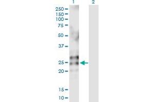 Western Blot analysis of RNASE2 expression in transfected 293T cell line by RNASE2 MaxPab polyclonal antibody. (RNASE2 antibody  (AA 1-161))
