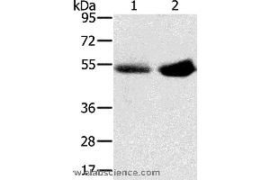 Western blot analysis of Human placenta and plasma tissue, using SLC13A3 Polyclonal Antibody at dilution of 1:200 (SLC13A3 antibody)