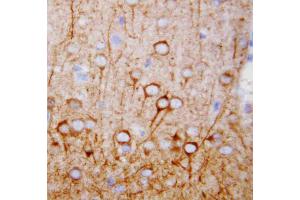 Anti-CaMKK antibody, IHC(P): Rat Brain Tissue