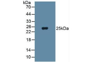 Western blot analysis of Human Blood Cells. (SOD3 antibody  (AA 19-240))