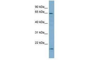 Image no. 1 for anti-Plastin 3 (PLS3) (AA 503-552) antibody (ABIN6749763) (Plastin 3 antibody  (AA 503-552))