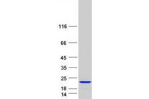 C1orf144 Protein (Transcript Variant 2) (Myc-DYKDDDDK Tag)