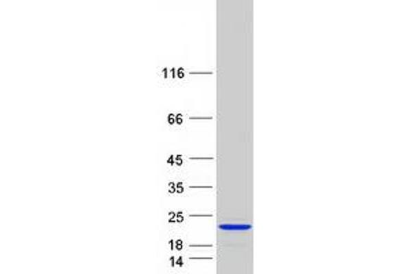 C1orf144 Protein (Transcript Variant 2) (Myc-DYKDDDDK Tag)