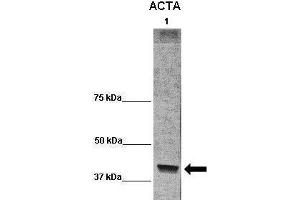 WB Suggested Anti-ACTA1 Antibody  Positive Control: Lane 1:541 µg term baboon muscle homogenate Primary Antibody Dilution: 1:0666Secondary Antibody: Anti-rabbit-HRP Secondry  Antibody Dilution: 1:0200Submitted by: Cynthia Blanco, University of Texas Health Science Center (Actin antibody  (C-Term))