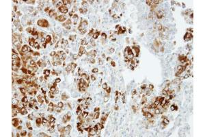 IHC-P Image Immunohistochemical analysis of paraffin-embedded CL1-5 xenograft, using Importin 13, antibody at 1:100 dilution. (IPO13 antibody  (C-Term))