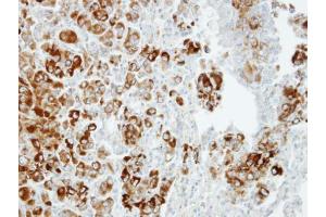 IHC-P Image Immunohistochemical analysis of paraffin-embedded CL1-5 xenograft, using Importin 13, antibody at 1:100 dilution.